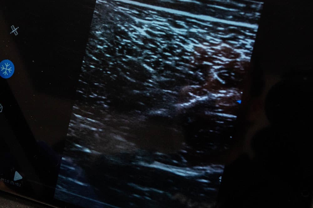 clinica de fisioterapia con ecografo en vigo