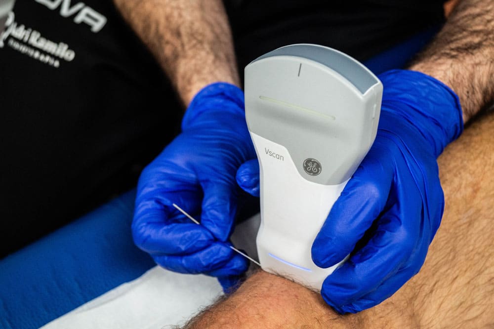 clinica de fisioterapia en vigo con EPTE (Electrólisis Percutánea Terapéutica)