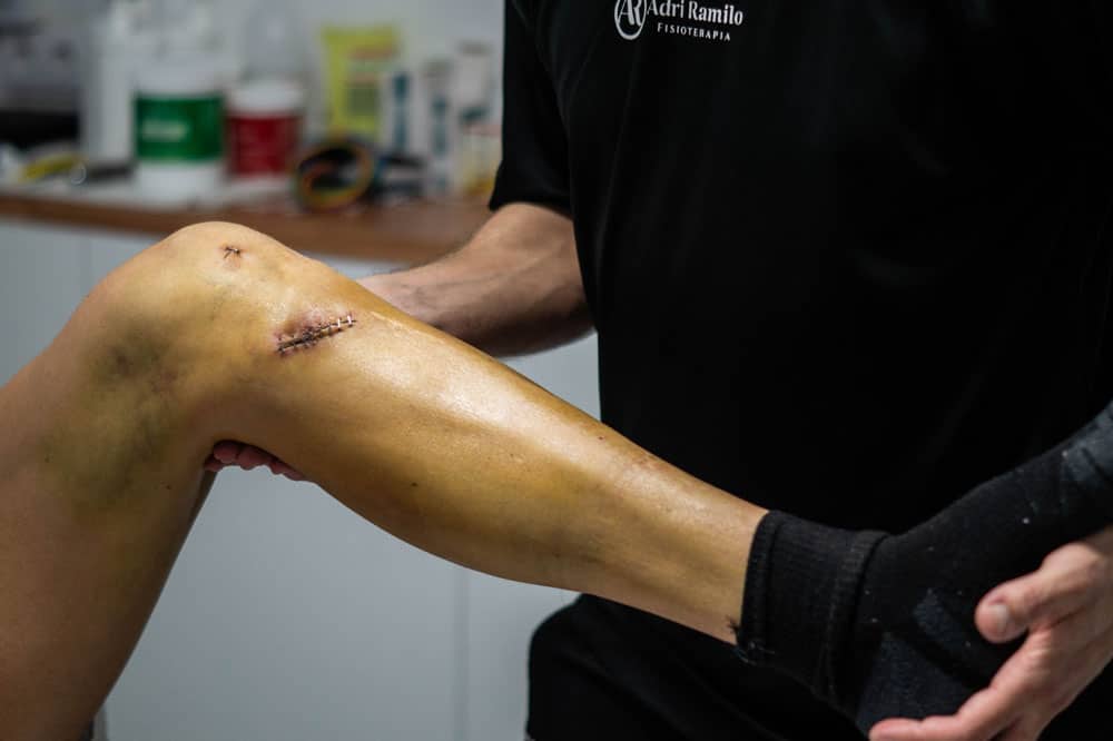 clinica de fisioterapia en vigo con el servicio de ejercicio terapeutico de recuperacion